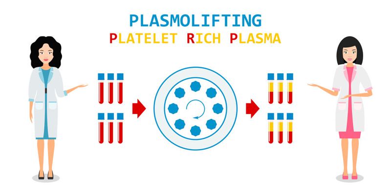 platelet rich plasma from a centrifuge