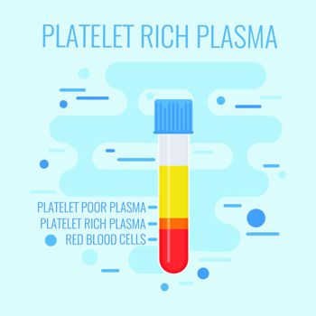 test tube showing blood layers and platelet rich plasma PRP