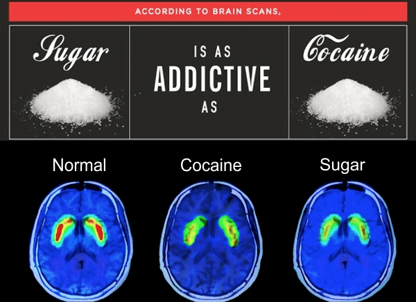 brain scans of cocaine and sugar addict