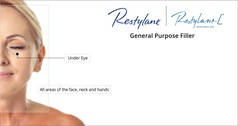 treatment areas restylane
